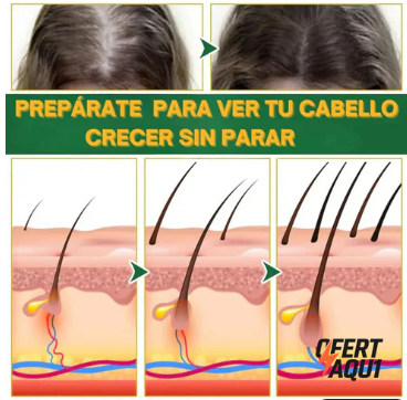 OUHOE . ELIXIR PARA EL CRECIMIENTO DEL CABELLO